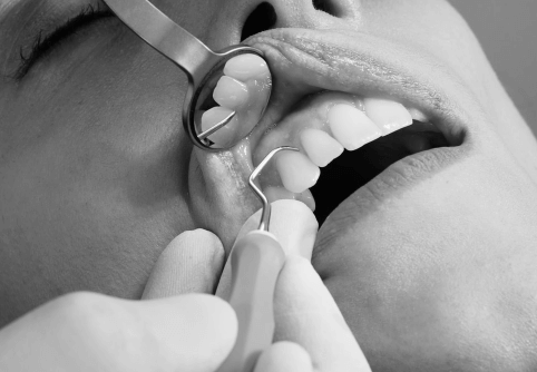 Tooth examination